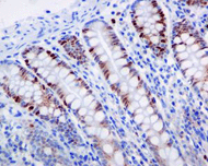 Immunohistochemistry (Formalin/PFA-fixed paraffin-embedded sections) - Anti-p60 CAF1/MPP7 antibody [EPR6105] (AB109442)