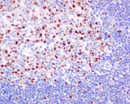 Immunohistochemistry (Formalin/PFA-fixed paraffin-embedded sections) - Anti-p60 CAF1/MPP7 antibody [EPR6105] - BSA and Azide free (AB226065)