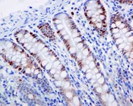 Immunohistochemistry (Formalin/PFA-fixed paraffin-embedded sections) - Anti-p60 CAF1/MPP7 antibody [EPR6105] - BSA and Azide free (AB226065)