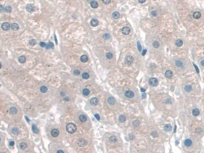 Immunohistochemistry (Formalin/PFA-fixed paraffin-embedded sections) - Anti-p60 katanin antibody (AB232891)