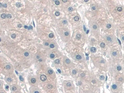 Immunohistochemistry (Formalin/PFA-fixed paraffin-embedded sections) - Anti-p60 katanin antibody (AB232891)