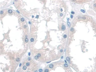 Immunohistochemistry (Formalin/PFA-fixed paraffin-embedded sections) - Anti-p60 katanin antibody (AB232891)