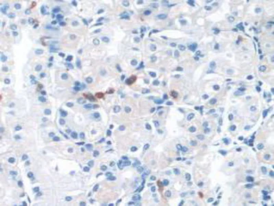 Immunohistochemistry (Formalin/PFA-fixed paraffin-embedded sections) - Anti-p60 katanin antibody (AB232891)
