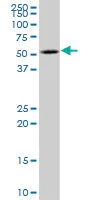 Western blot - Anti-p60 katanin antibody (AB67206)
