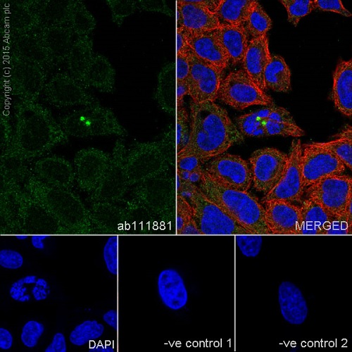 Immunocytochemistry/ Immunofluorescence - Anti-p60 katanin antibody [EPR5071] (AB111881)