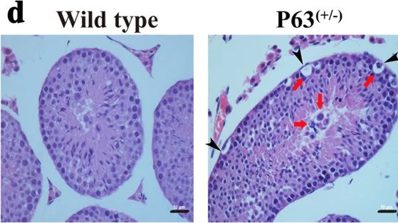 Immunohistochemistry (Formalin/PFA-fixed paraffin-embedded sections) - Anti-p63 antibody [4A4] (AB735)