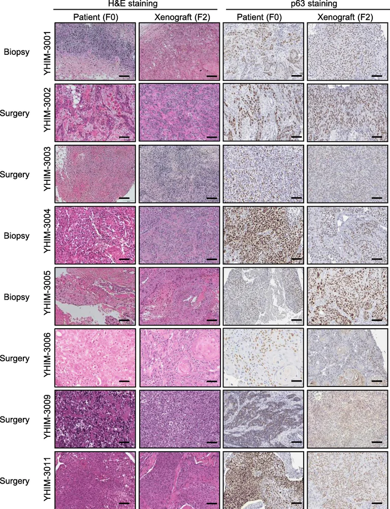 Immunohistochemistry (Formalin/PFA-fixed paraffin-embedded sections) - Anti-p63 antibody [4A4] (AB735)