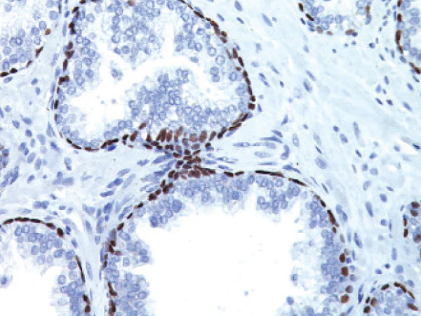 Immunohistochemistry (Formalin/PFA-fixed paraffin-embedded sections) - Anti-p63 antibody [4A4] (AB735)