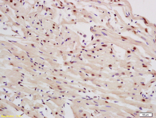 Immunohistochemistry (Formalin/PFA-fixed paraffin-embedded sections) - Anti-p63 antibody (AB216493)