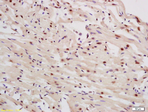 Immunohistochemistry (Formalin/PFA-fixed paraffin-embedded sections) - Anti-p63 antibody (AB216493)