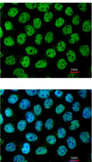 Immunocytochemistry/ Immunofluorescence - Anti-p63 antibody (AB97865), expandable thumbnail