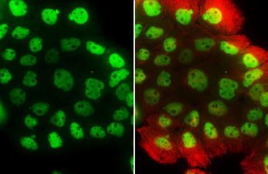 Immunocytochemistry/ Immunofluorescence - Anti-p63 antibody (AB97865), expandable thumbnail