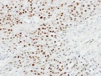 Immunohistochemistry (Formalin/PFA-fixed paraffin-embedded sections) - Anti-p63 antibody (ab97865), expandable thumbnail