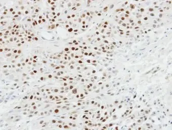 Immunohistochemistry (Formalin/PFA-fixed paraffin-embedded sections) - Anti-p63 antibody (AB97865)