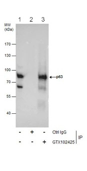 Immunoprecipitation - Anti-p63 antibody (ab97865), expandable thumbnail