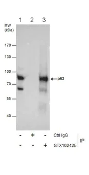 Immunoprecipitation - Anti-p63 antibody (AB97865)