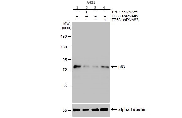 Western blot - Anti-p63 antibody (AB97865), expandable thumbnail