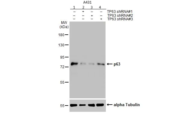 Western blot - Anti-p63 antibody (AB97865)