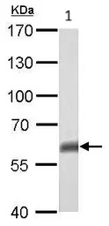 Western blot - Anti-p63 antibody (ab97865), expandable thumbnail
