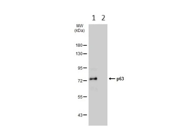 Western blot - Anti-p63 antibody (ab97865), expandable thumbnail