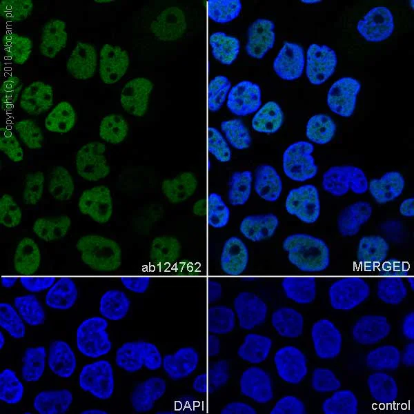 Immunocytochemistry/ Immunofluorescence - Anti-p63 antibody [EPR5701] (AB124762)
