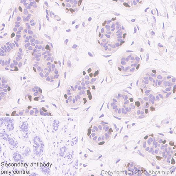 Immunohistochemistry (Formalin/PFA-fixed paraffin-embedded sections) - Anti-p63 antibody [EPR5701] (AB124762), expandable thumbnail