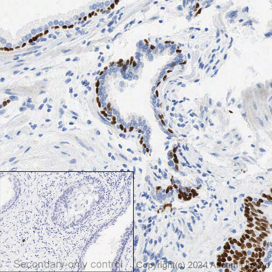 Immunohistochemistry - Anti-p63 antibody [EPR5701] (ab124762), expandable thumbnail