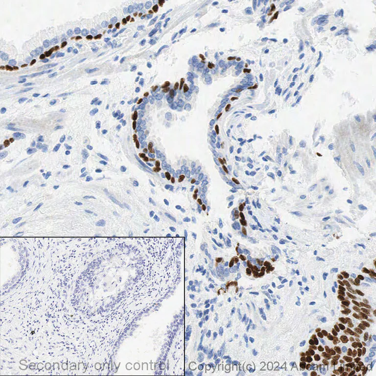 Immunohistochemistry - Anti-p63 antibody [EPR5701] (AB124762)