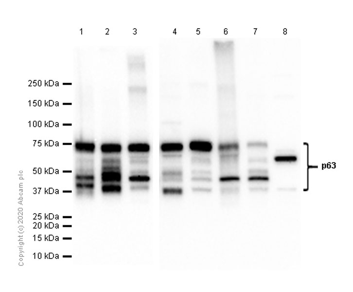 Western blot - Anti-p63 antibody [EPR5701] (AB124762), expandable thumbnail