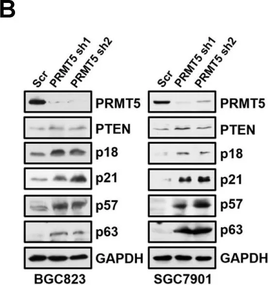 Western blot - Anti-p63 antibody [EPR5701] (AB124762)