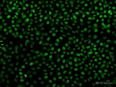 Immunocytochemistry/ Immunofluorescence - Anti-p63 antibody [EPR5701] - BSA and Azide free (AB214790)