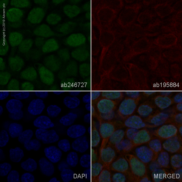 Immunocytochemistry/ Immunofluorescence - Anti-p63 antibody [EPR5701] - BSA and Azide free (ab214790), expandable thumbnail