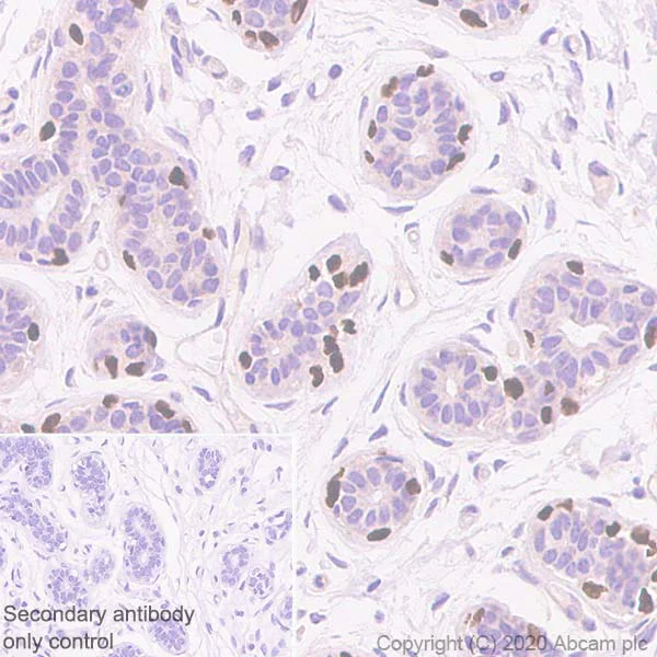 Immunohistochemistry (Formalin/PFA-fixed paraffin-embedded sections) - Anti-p63 antibody [EPR5701] - BSA and Azide free (AB214790)