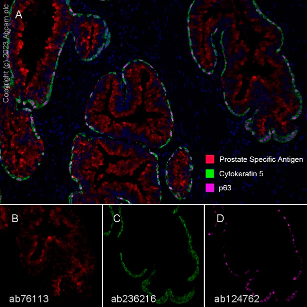 Multiplex immunohistochemistry - Anti-p63 antibody [EPR5701] - BSA and Azide free (AB214790)