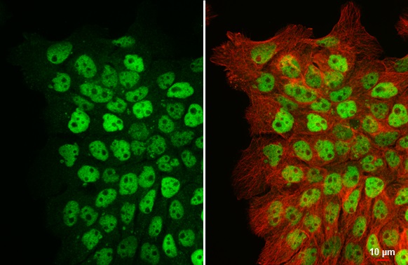 Immunocytochemistry/ Immunofluorescence - Anti-p63 antibody [HL1027] (ab308376), expandable thumbnail