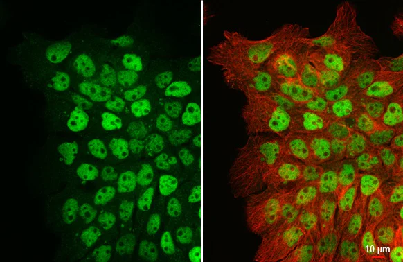 Immunocytochemistry/ Immunofluorescence - Anti-p63 antibody [HL1027] (AB308376)