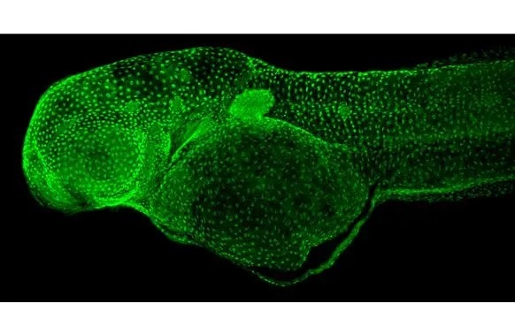 Immunohistochemistry (Formalin/PFA-fixed paraffin-embedded sections) - Anti-p63 antibody [HL1027] (AB308376), expandable thumbnail