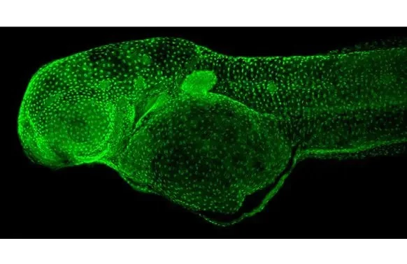 Immunohistochemistry (Formalin/PFA-fixed paraffin-embedded sections) - Anti-p63 antibody [HL1027] (AB308376)