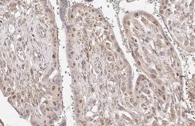 Immunohistochemistry (Formalin/PFA-fixed paraffin-embedded sections) - Anti-p63 antibody [HL1027] (AB308376), expandable thumbnail