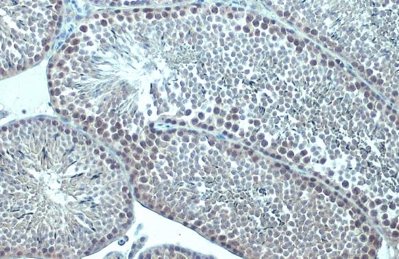Immunohistochemistry paraffin embedded sections - Anti-p63 antibody [HL1027] (AB308376), expandable thumbnail