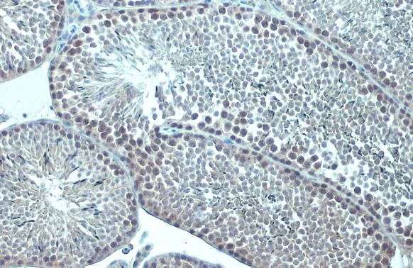 Immunohistochemistry paraffin embedded sections - Anti-p63 antibody [HL1027] (AB308376)