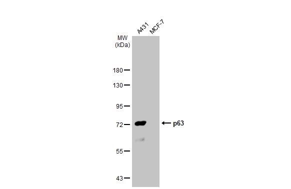 Western blot - Anti-p63 antibody [HL1027] (ab308376), expandable thumbnail