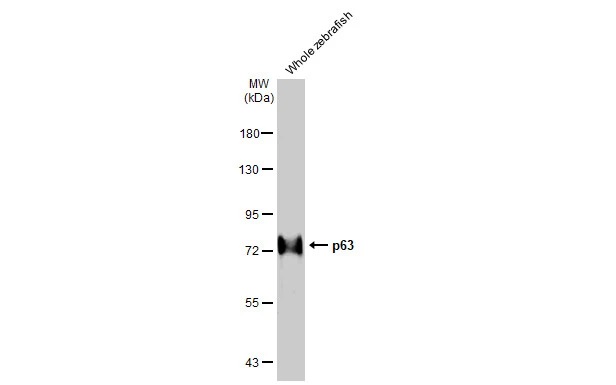 Western blot - Anti-p63 antibody [HL1027] (AB308376), expandable thumbnail