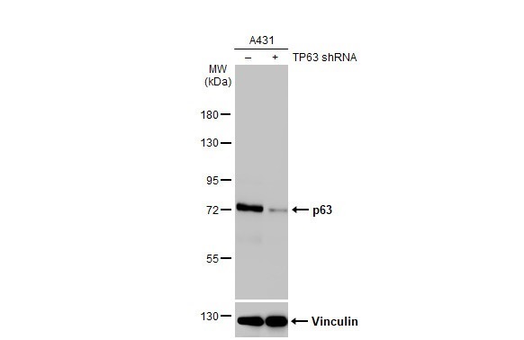 Western blot - Anti-p63 antibody [HL1027] (AB308376), expandable thumbnail