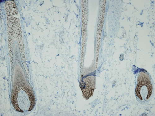 Immunohistochemistry (Formalin/PFA-fixed paraffin-embedded sections) - Anti-p63 antibody [I27-I] (AB169707)