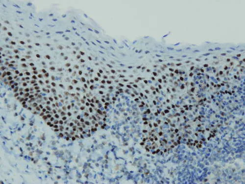 Immunohistochemistry (Formalin/PFA-fixed paraffin-embedded sections) - Anti-p63 antibody [I27-I] (AB169707)