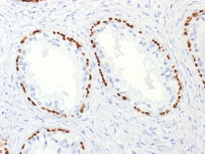 Immunohistochemistry (Formalin/PFA-fixed paraffin-embedded sections) - Anti-p63 antibody [TP63/2427] (AB238079)