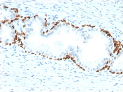 Immunohistochemistry (Formalin/PFA-fixed paraffin-embedded sections) - Anti-p63 antibody [TP63/2428] - BSA and Azide free (AB237934), expandable thumbnail