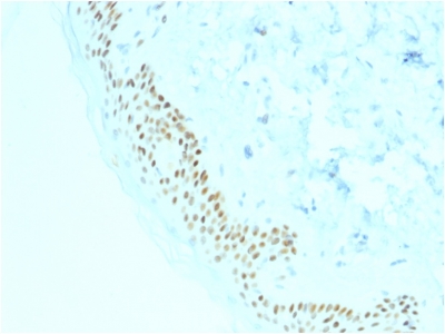 Immunohistochemistry (Formalin/PFA-fixed paraffin-embedded sections) - Anti-p63 antibody [TP63/2428] - BSA and Azide free (AB237934), expandable thumbnail