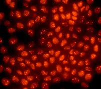 Immunocytochemistry/ Immunofluorescence - Anti-p63 antibody [Y289] (AB32353)